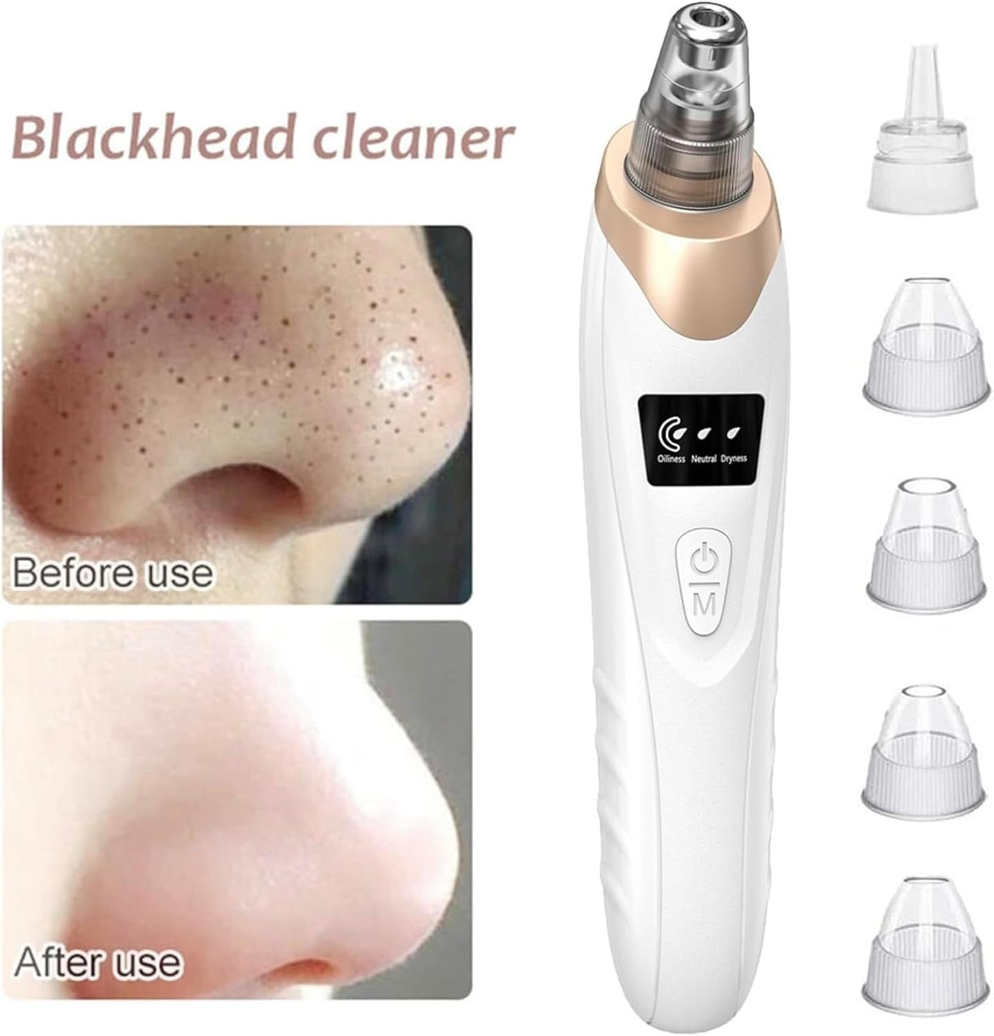 Blackhead Remover Vacuum